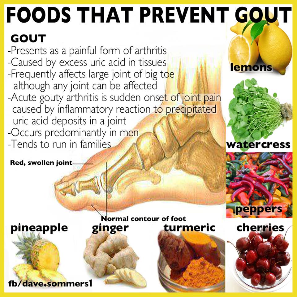 gout cure